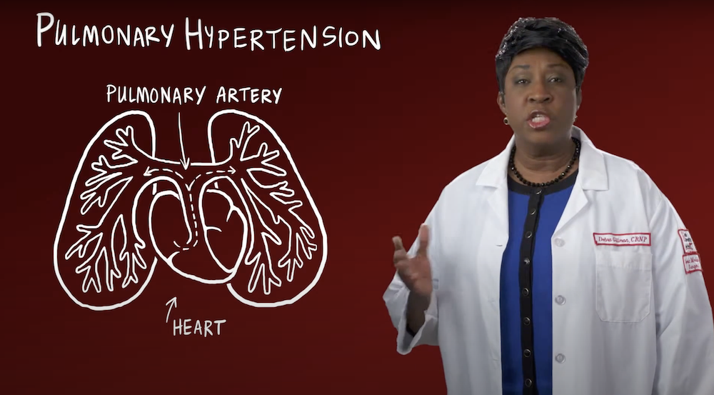 Pulmonary Hypertension Treatment Options | Temple Health